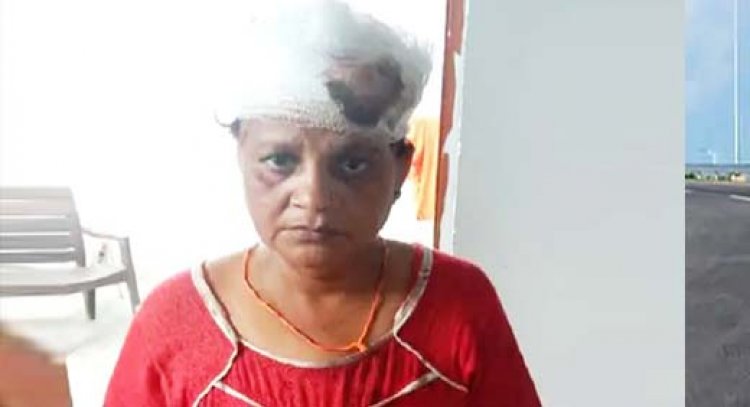 लखनऊ में भोर पहर घर में घुसे चार बदमाशों ने डंडे से हाथ व सिर पर हमला कर महिला को किया घायल, सूचना के दो घंटे बाद पहुंची पुलिस