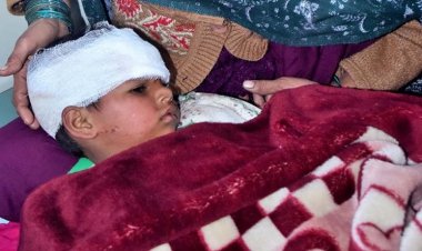 मुरादाबाद के थाना डिलारी में अज्ञात जानवर  के हमले से फैली दहशत : हमले में 9 ग्रामीण घायल,तेंदुए की हमले की अफवाह से पूरे गांव में हड़कंप